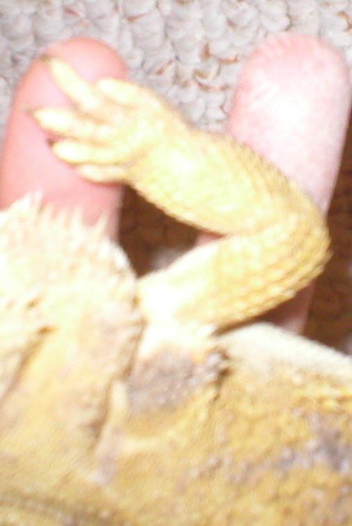 daisy arm