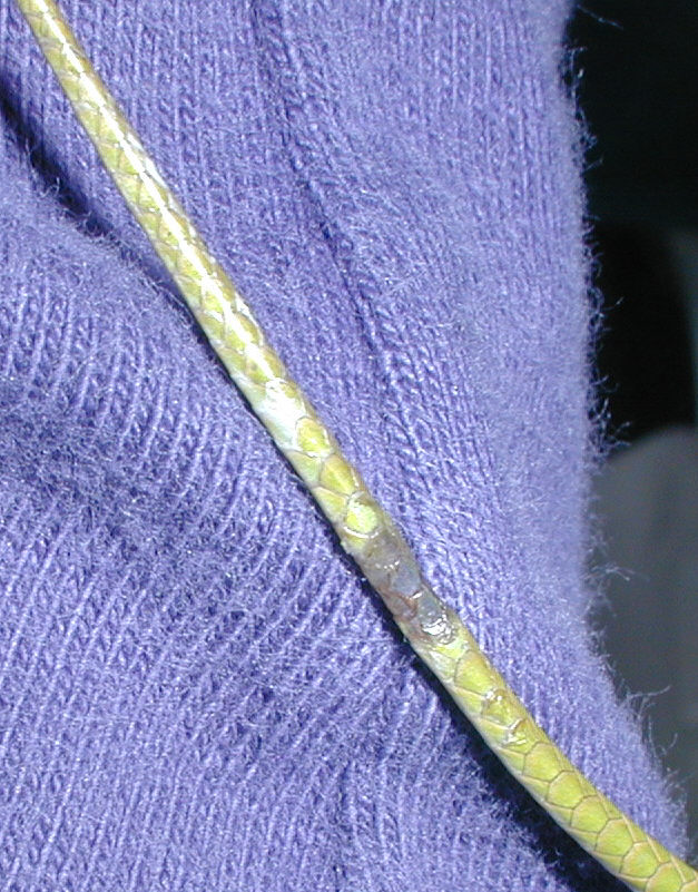 Tail trauma1