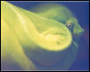 GTP