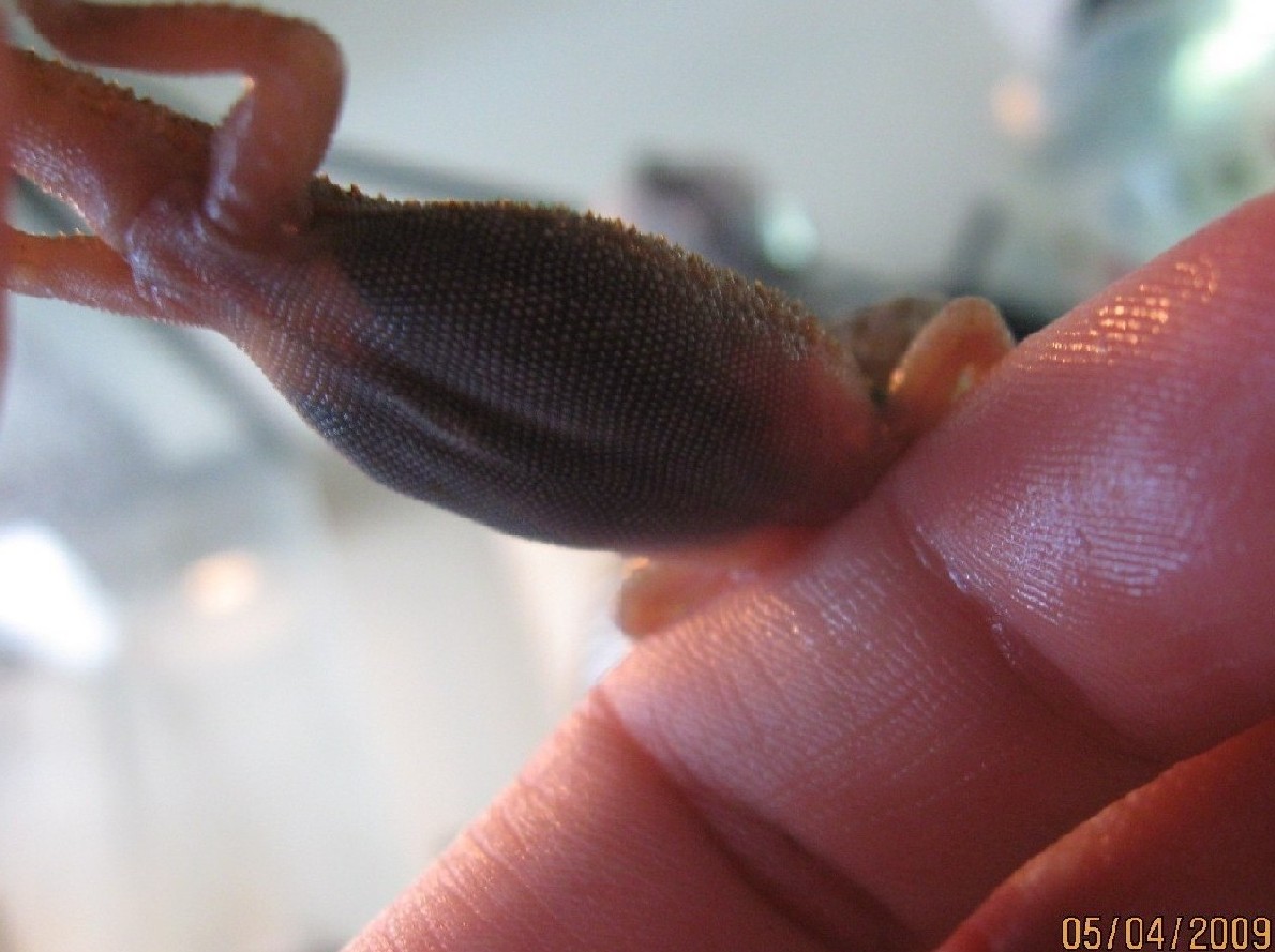 Hypo trans belly