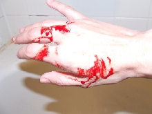 Bite!  SFE