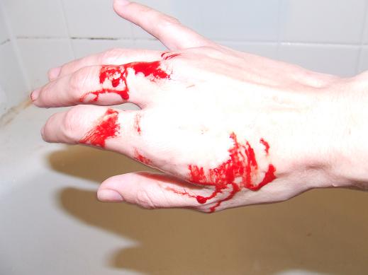 Bite!  SFE