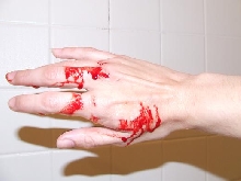Bite part 2
