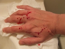 Beeding up