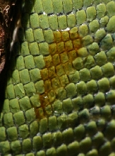 fungal infection