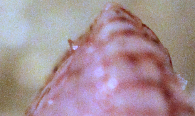 egg tooth pic2