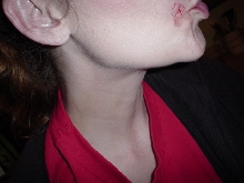Andys first bite on mom