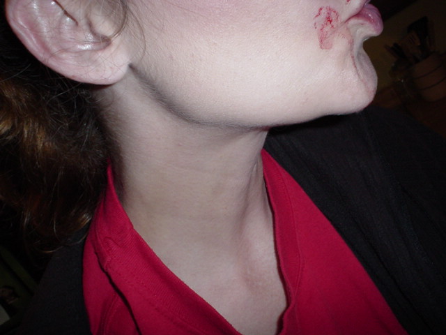Andys first bite on mom