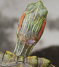 Neck Wound