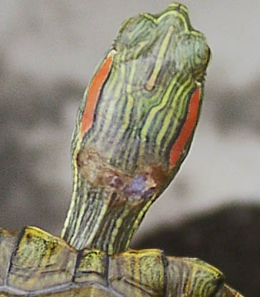 Neck Wound