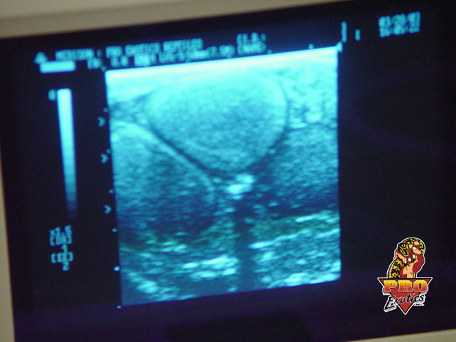 Gila ultrasound