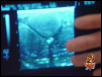 Gila ultrasound