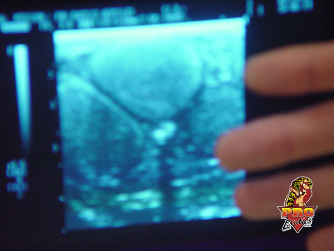 Gila ultrasound