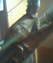 lumpy right side