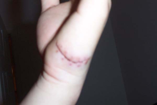 aftermath3