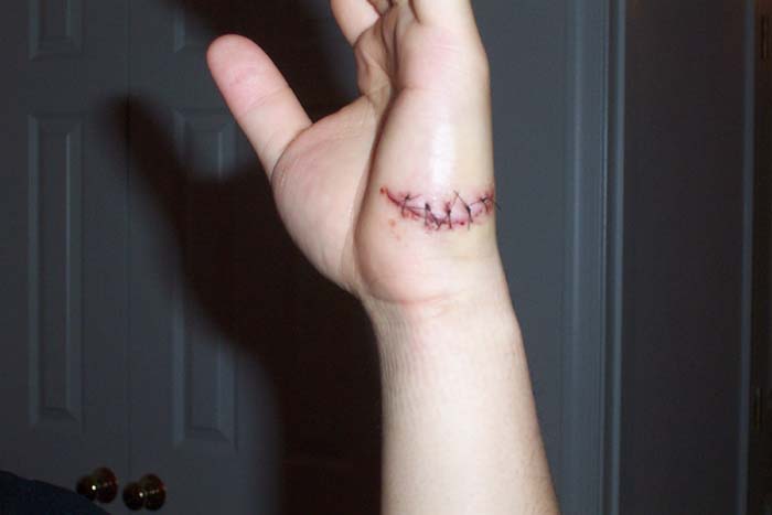 Cut 1