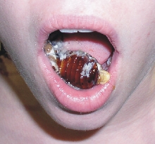 Hisser Anyone?