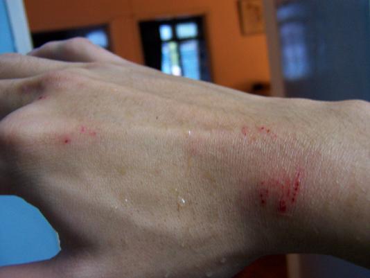 ornata bite