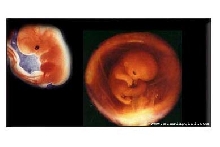 What my baby looks like