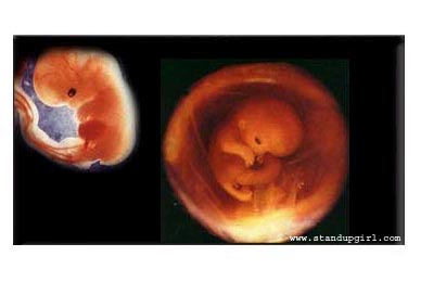 What my baby looks like