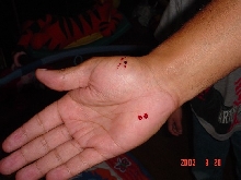 blood1