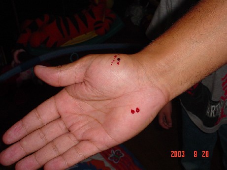 blood1