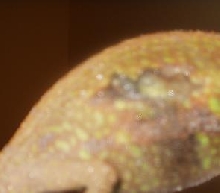 Ben with bad skin