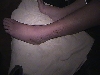 Ankle #1