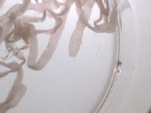 Tapeworms1 from Anaconda