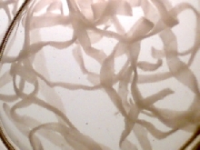 Tapeworms2? from Anaconda