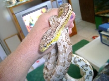 swelling in neck