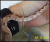 hypo tail