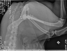 Total Hip Replacement