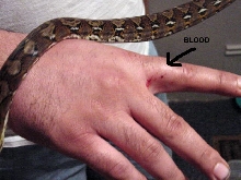 Snake bite
