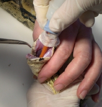 During Surgery