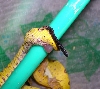 prolapse