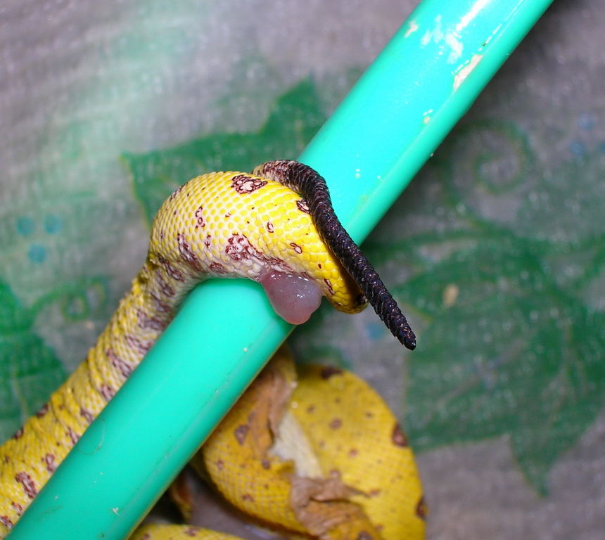 prolapse