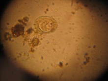 Parasite Egg?