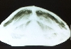 turtle rads