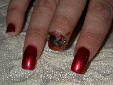 Tiger bite