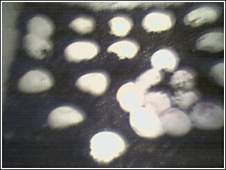 Eggs