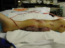 My body modification