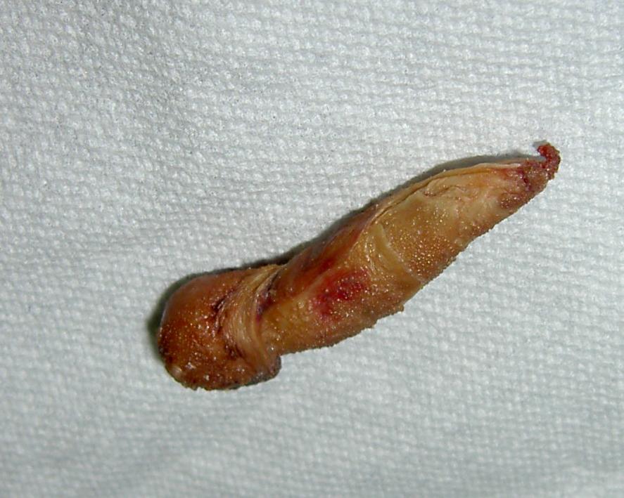 plug1