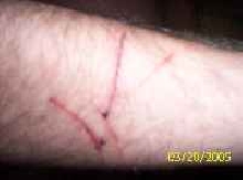 lizard scratch
