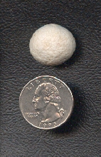 One of two bladder stones this size removed from Tootles
