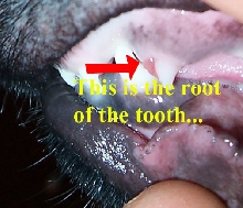 Cracked tooth