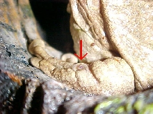 Hole in Beady's Arm