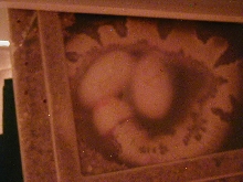 egg pics