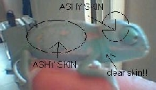 dry skin problem???