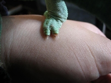 broken toe?